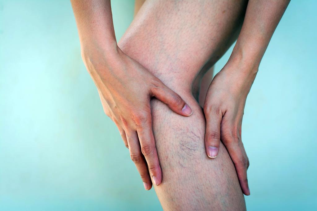 Varis Ağrısı Nasıl Geçer? Evde Uygulanabilecek 5 Yöntem